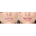 FacEvolution LipPlus Lip Booster Lesk na rty pro plné a smyslné rty 5 ml